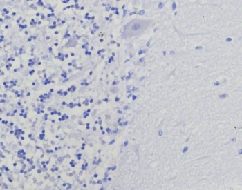 Recombinant Thymidylate Synthase Antibody / TYMS