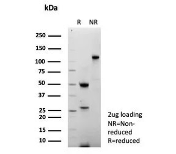 Recombinant Thymidylate Synthase Antibody / TYMS