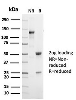 p53 Tumor Suppressor Protein Antibody