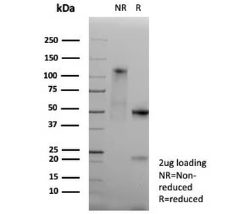 Recombinant HLA-DP/DQ/DR Antibody / MHC II
