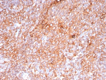 Recombinant HLA-DP/DQ/DR Antibody / MHC II