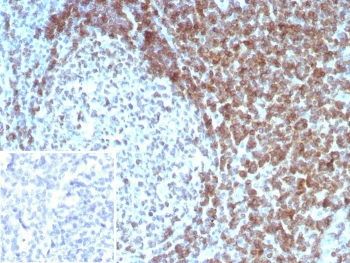 CD3 delta Antibody