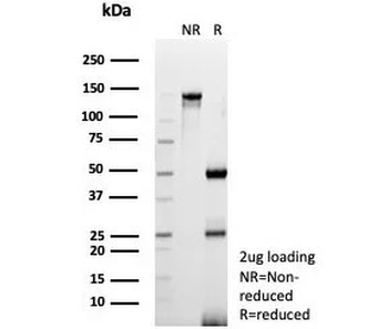 CD3 delta Antibody