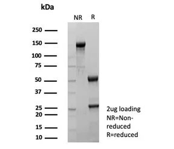 Recombinant TFF1 Antibody / Estrogen Inducible Protein pS2