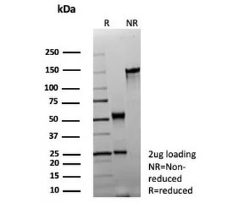 Recombinant MBP Antibody / Myelin Basic Protein