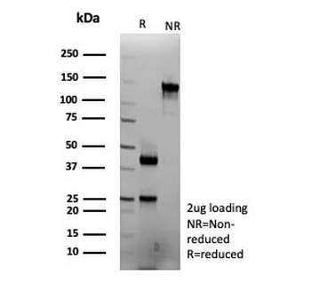 Interferon gamma Antibody / IFNG