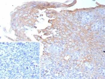Interferon gamma Antibody / IFNG