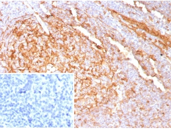 Recombinant Cystatin A Antibody / CSTA