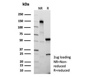 Recombinant Cystatin A Antibody / CSTA