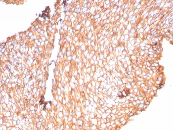 Recombinant Uroplakin 1B Antibody / UPK1B