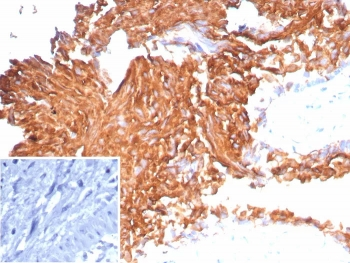 Recombinant Uroplakin 1B Antibody / UPK1B