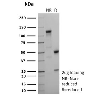 Blood Group Lewis y Antibody