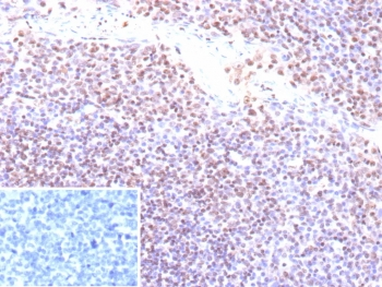 Recombinant EBV Antibody / Epstein-Barr Virus