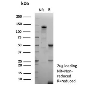 Recombinant EBV Antibody / Epstein-Barr Virus