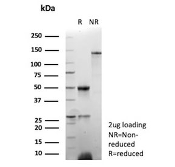 Recombinant Epstein-Barr Virus Antibody / EBV