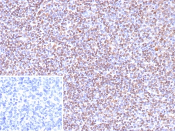 Recombinant Epstein-Barr Virus Antibody / EBV