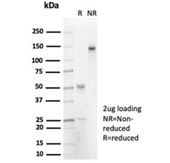 Recombinant IL-7 Antibody