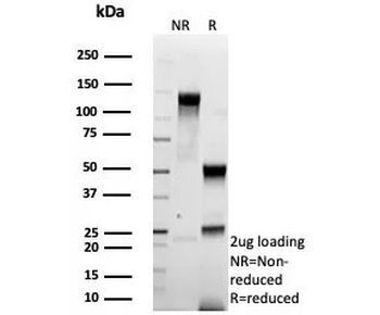 Recombinant HER-2 Antibody / ErbB2