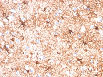 Glial Fibrillary Acidic Protein Antibody / GFAP