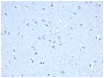 IDH1 Antibody / Isocitrate Dehydrogenase (R132H mutant)