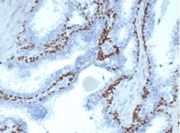 Recombinant p63 Antibody / Tumor protein 63