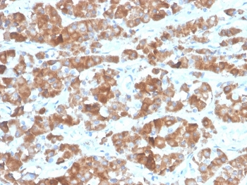 Recombinant Luteinizing Hormone beta Antibody
