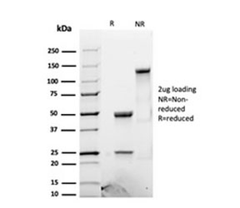 Recombinant Luteinizing Hormone beta Antibody