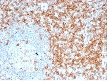Recombinant CD5 Antibody
