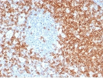 Recombinant CD5 Antibody