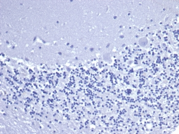 Recombinant CD5 Antibody