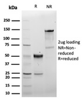 Recombinant CD5 Antibody
