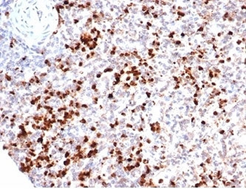 Recombinant MPO Antibody / Myeloperoxidase