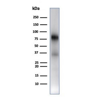 Recombinant MPO Antibody / Myeloperoxidase