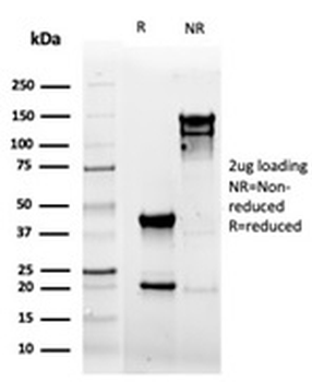 Recombinant CD5 Antibody
