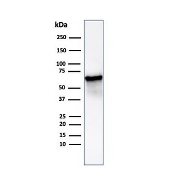 HSP60/GROEL Antibody