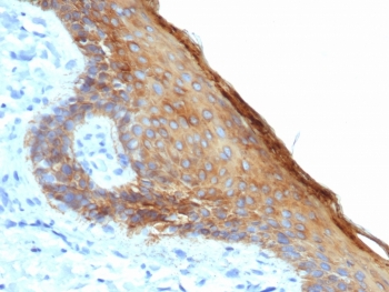 Recombinant Basic Cytokeratin Antibody (HMW / Type II)