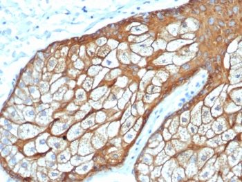 Recombinant Basic Cytokeratin Antibody (HMW / Type II)