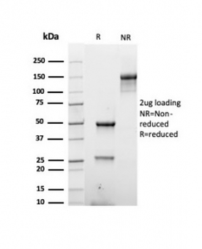 Recombinant Basic Cytokeratin Antibody (HMW / Type II)