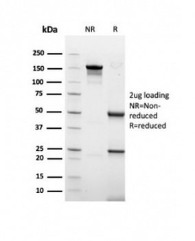 Recombinant Acidic Cytokeratin Antibody (LMW / Type I)
