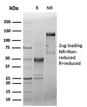 Recombinant CD44 Antibody / HCAM