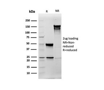 Vimentin Antibody