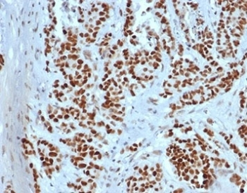 Recombinant MSH2 Antibody