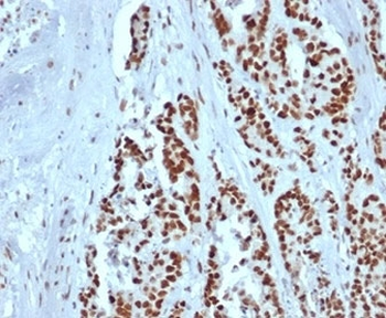 Recombinant MSH2 Antibody