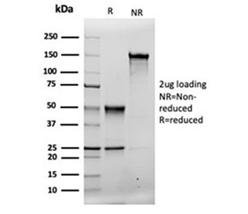 Recombinant MSH2 Antibody