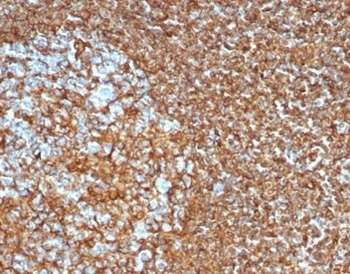 Recombinant Vimentin Antibody