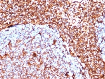 Recombinant Vimentin Antibody