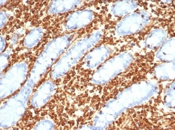 Recombinant Vimentin Antibody