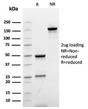 Recombinant Ki67 Antibody