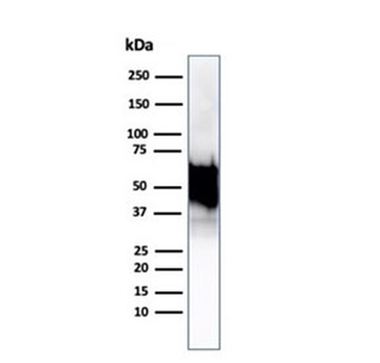 Recombinant HSP60 Antibody