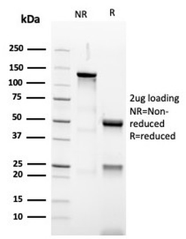 Recombinant PAX5 Antibody